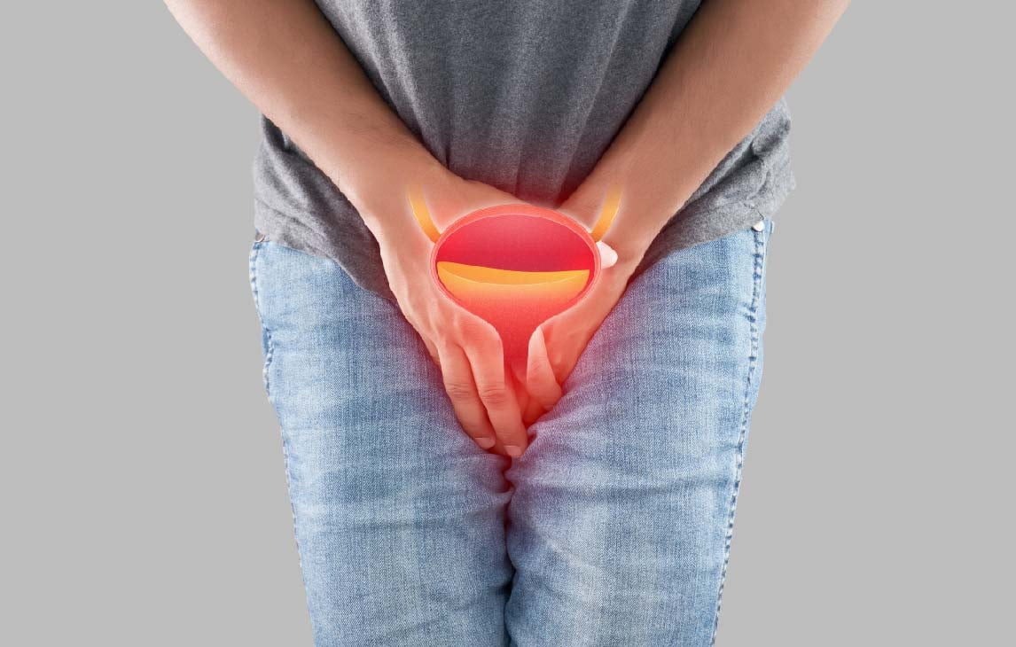 Việc phát hiện sớm có vai trò quan trọng trong việc tìm ra phương hướng điều trị bệnh hiệu quả (Hình minh họa/Z Urology)